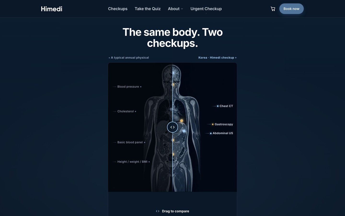 The same body, two checkups comparison on the himedi.com homepage, with the whole-body scan behind its drag divider.